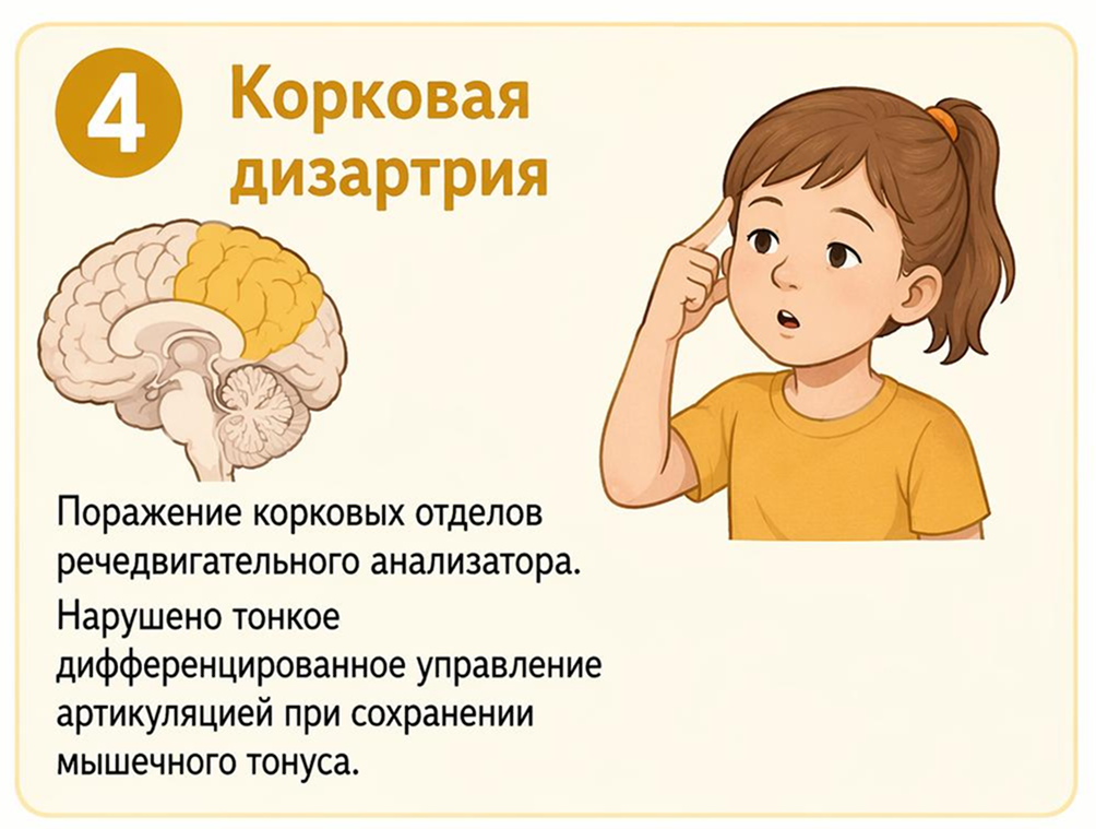 Корковая дизартрия